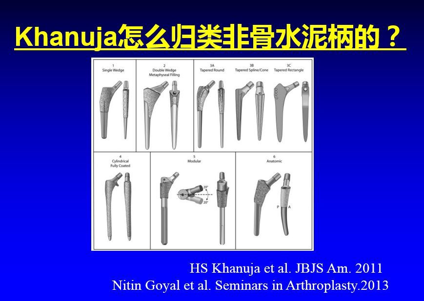 高绪仁:人工全髋关节置换手术各种非骨水泥股骨柄各有何特点.