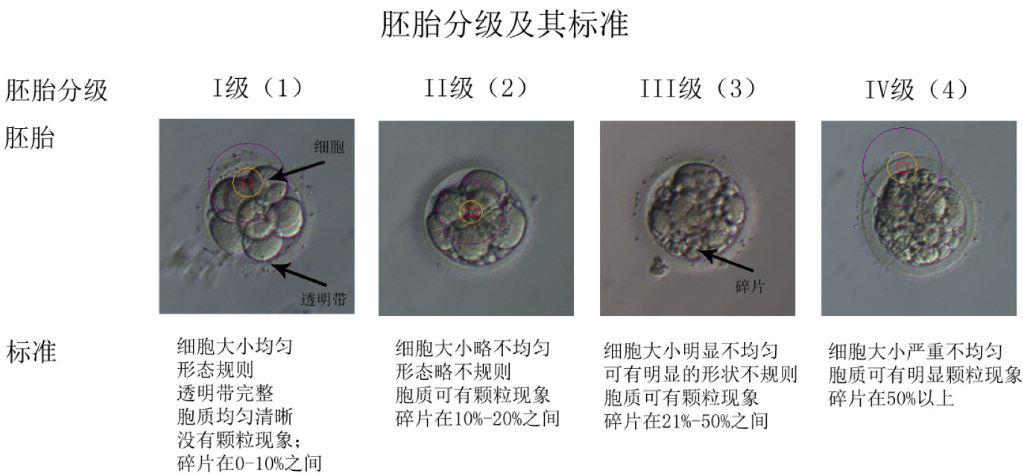 胚胎评分 目前按照细胞数目,细胞均一度,细胞胞浆形态和碎片程度进行