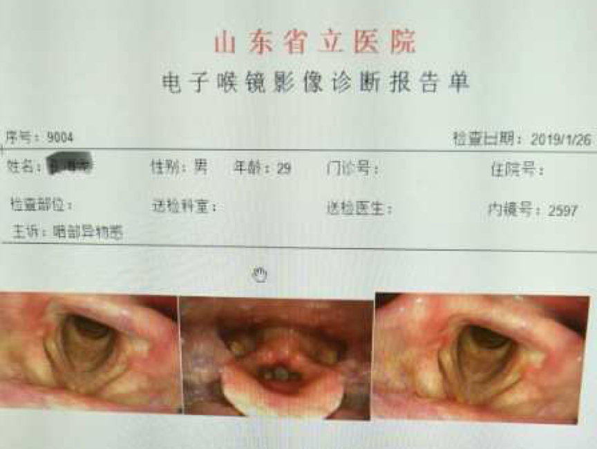 单侧声带麻痹规范检查内容解析及预后评价