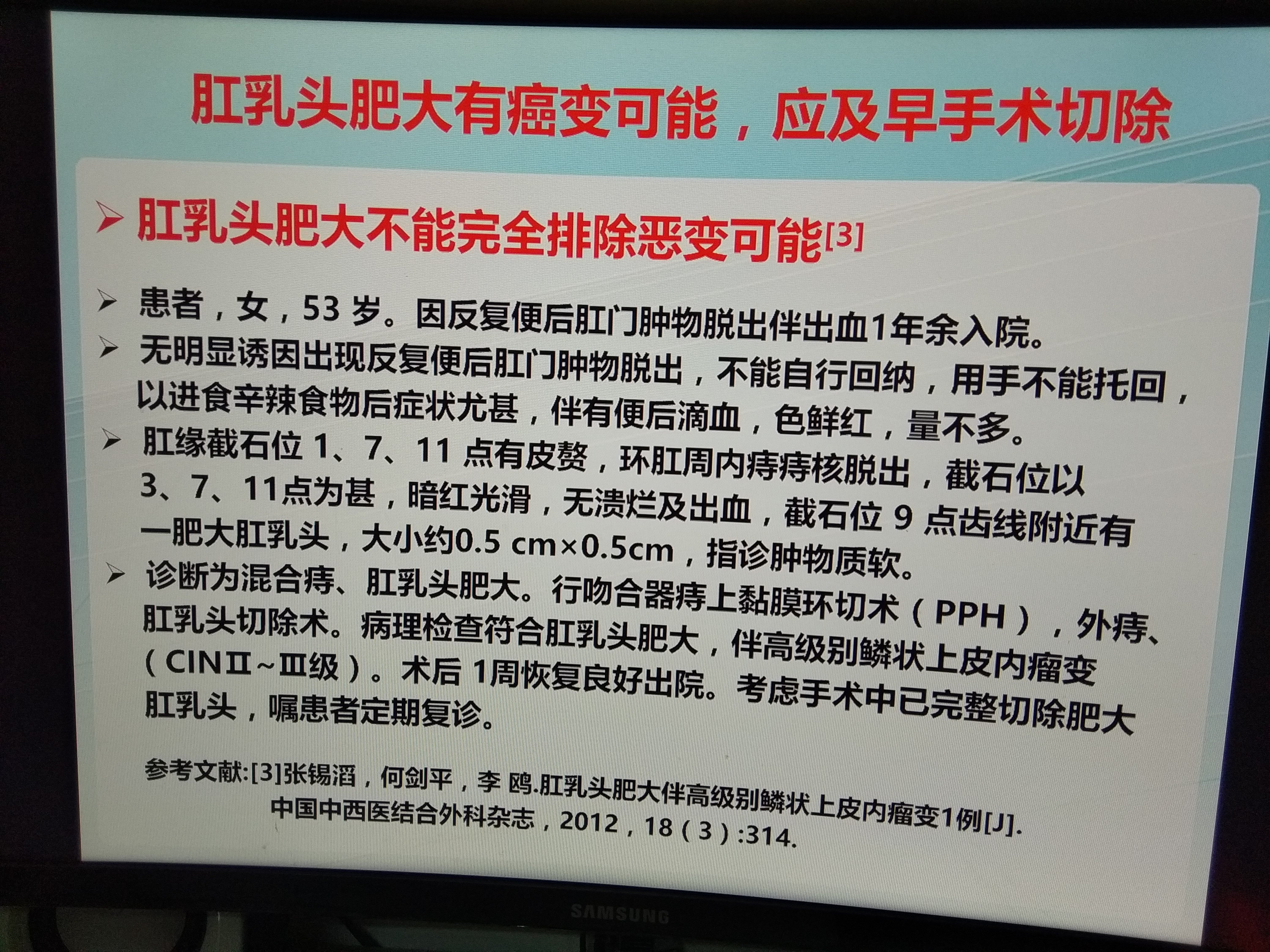 肛乳头肥大有癌变可能应尽早手术切除