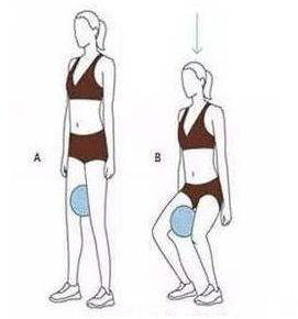 o型腿,腿不直怎么办?能通过锻炼纠正吗?