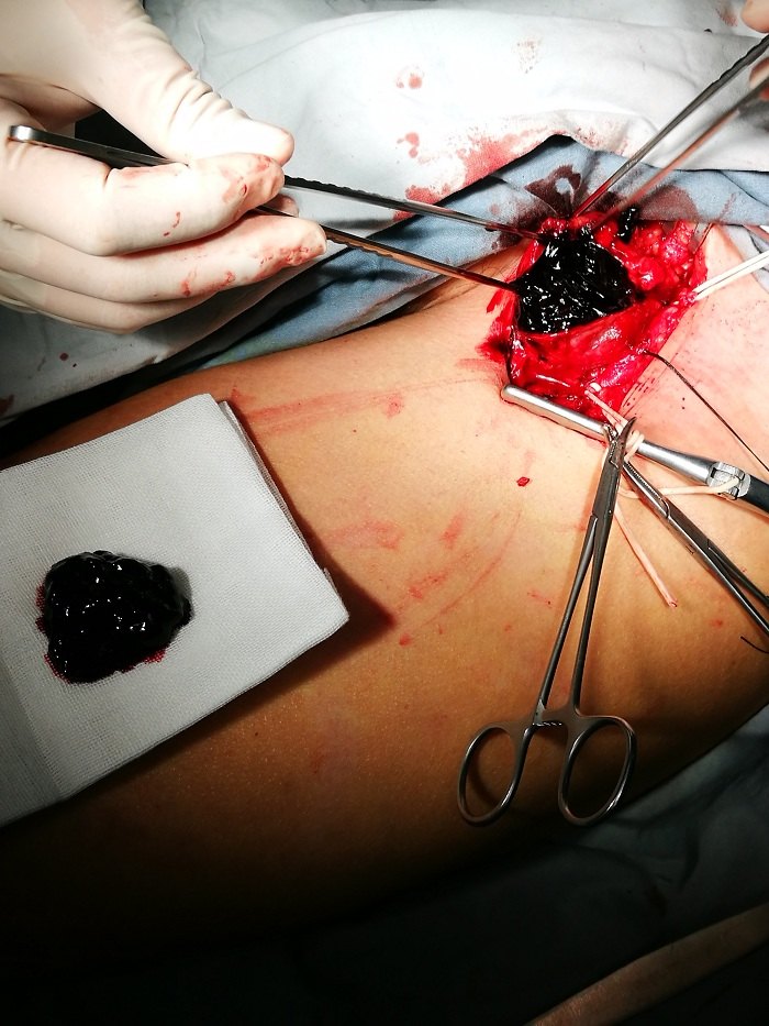 1494162662325112.jpg 1494162662325112.jpg