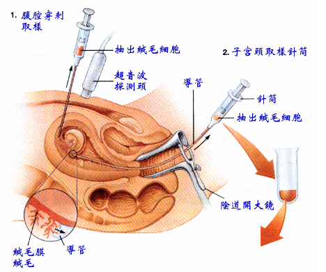 绒毛膜与绒毛膜活检