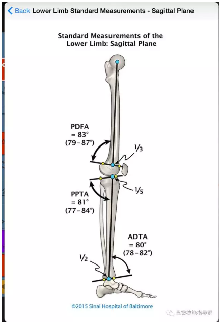 (b)侧面观(a)正面观正常下肢解剖轴和机械轴示意图(the art of limb