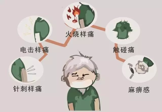 三叉神经痛为何痛不欲生