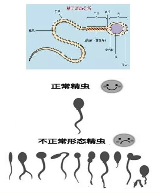 精子畸形率90%,怎么会这么高?应该如何治疗?