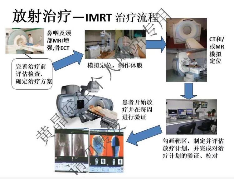 头颈部肿瘤放疗流程简介