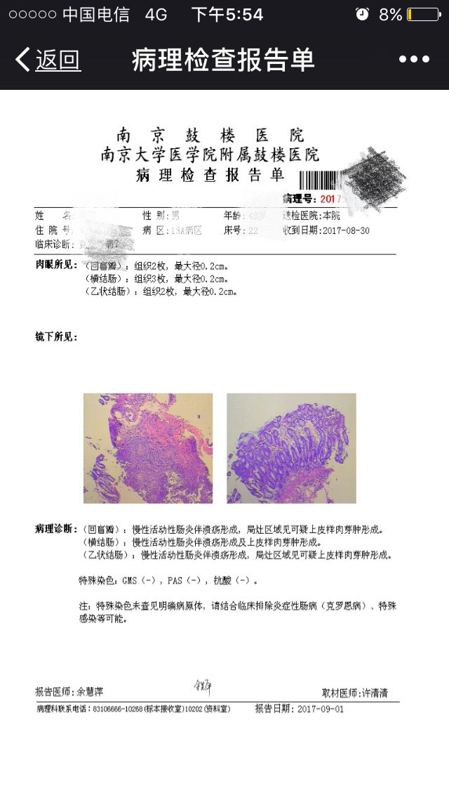 确诊克罗恩病一例