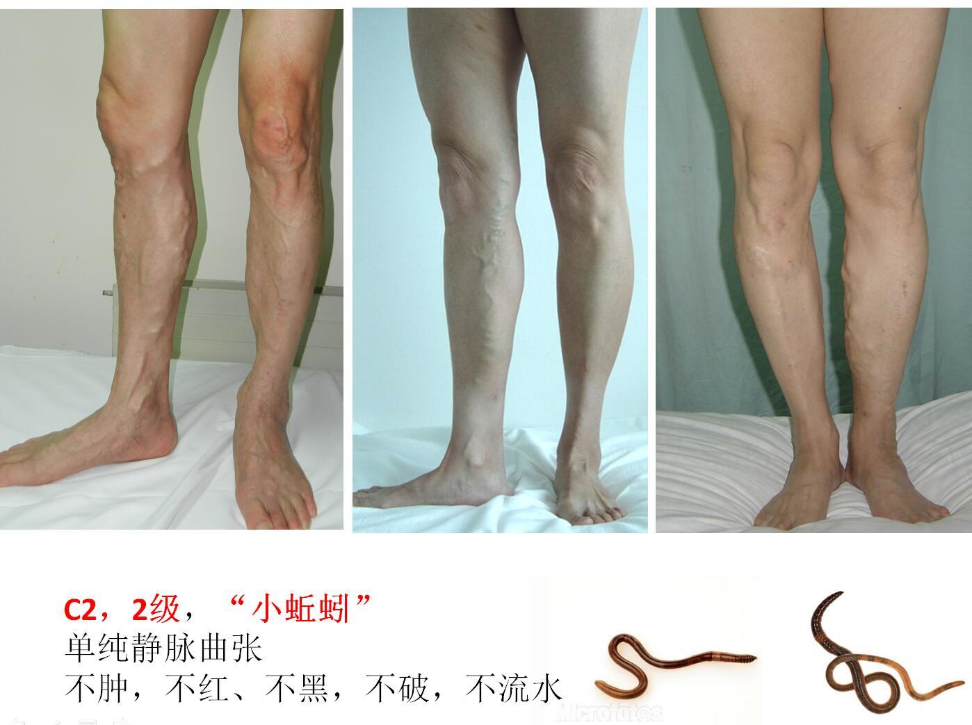 1504446006384902.jpg C2.jpg