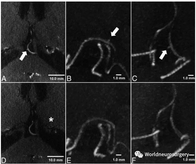 1508069125905175.png blob.png