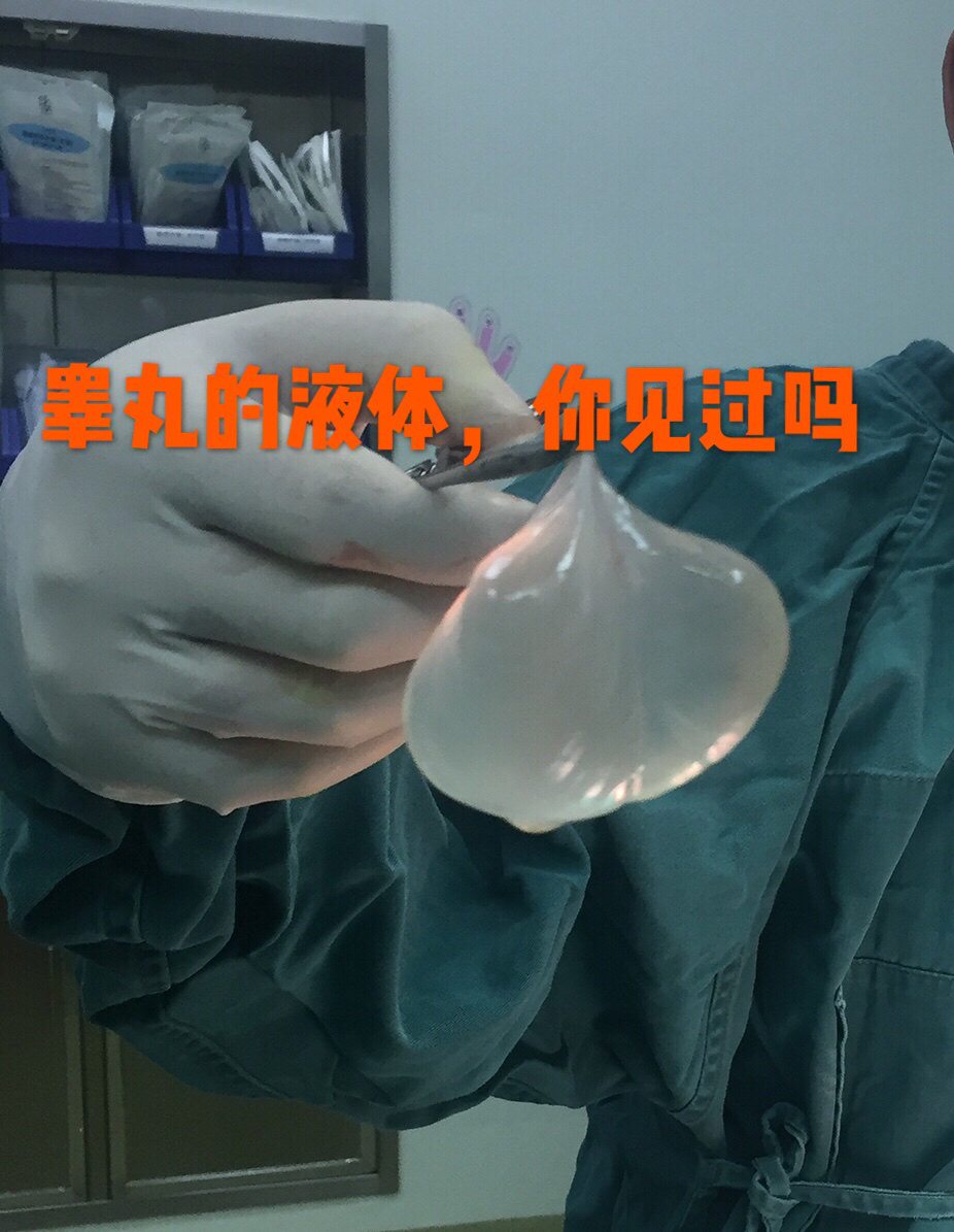 睾丸变大了,需要警惕