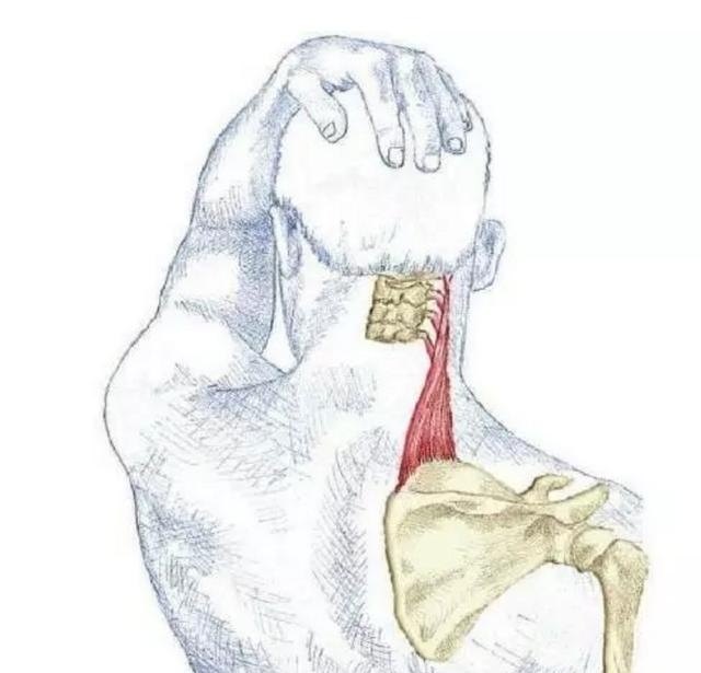 精准拉伸(6)肩胛提肌