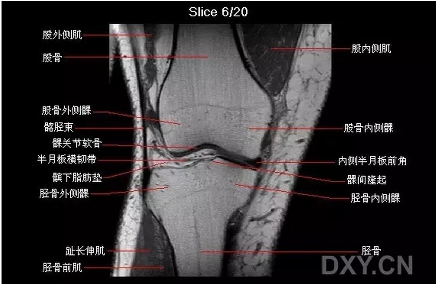 【关节影像】膝关节的磁共振(mri)解剖表现