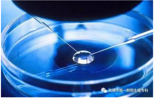 1501391361441077.png blob.png