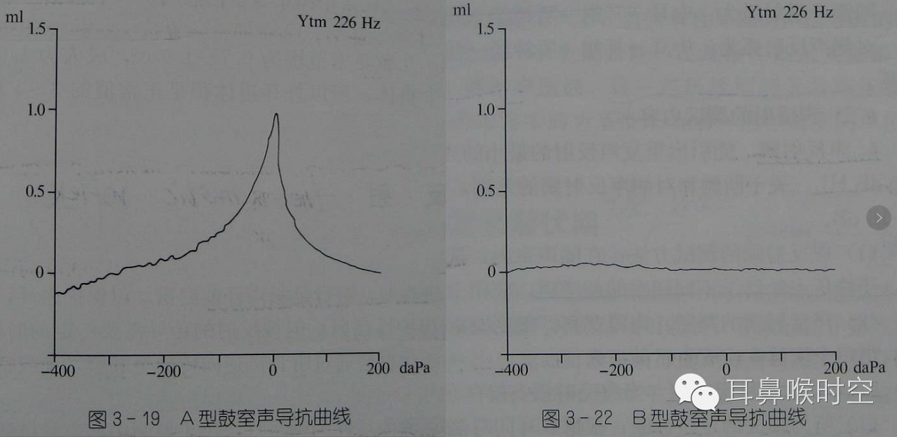 耳鸣等 常规检查:电耳镜,耳内镜,显微镜 听力学检查:纯音测听,声导抗
