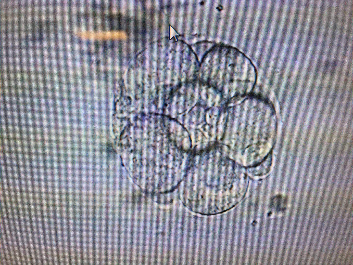 胚胎素材-胚胎图片-胚胎素材图片下载-觅知网