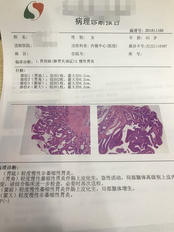 术后结合病理,多半都不需要开刀切除胃