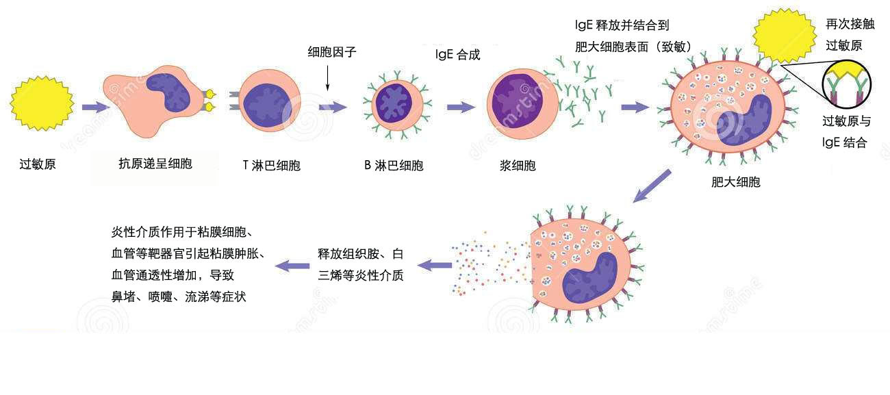 过敏性鼻炎科普之一:什么是过敏性鼻炎?该病是