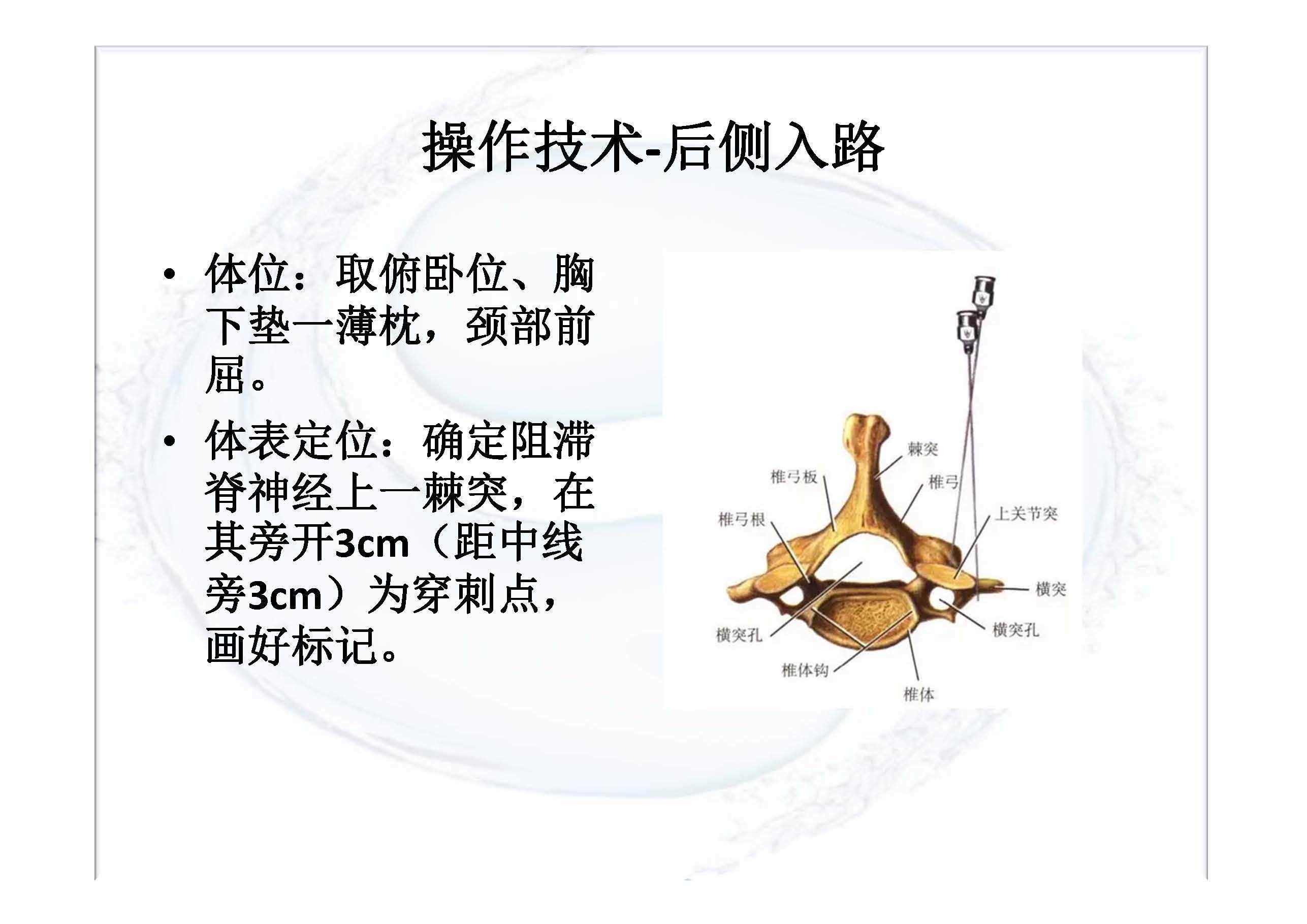 实用颈椎椎旁神经阻滞