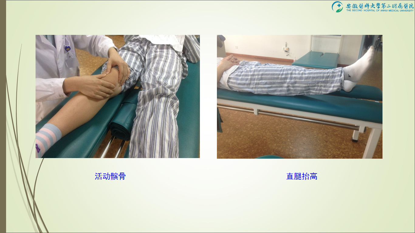 前交叉韧带损伤术后康复治疗