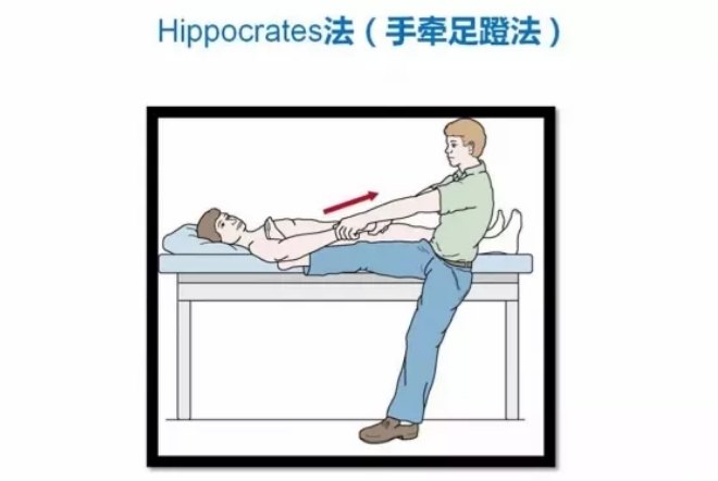 关节脱位肩关节前脱位的多种手法复位方法