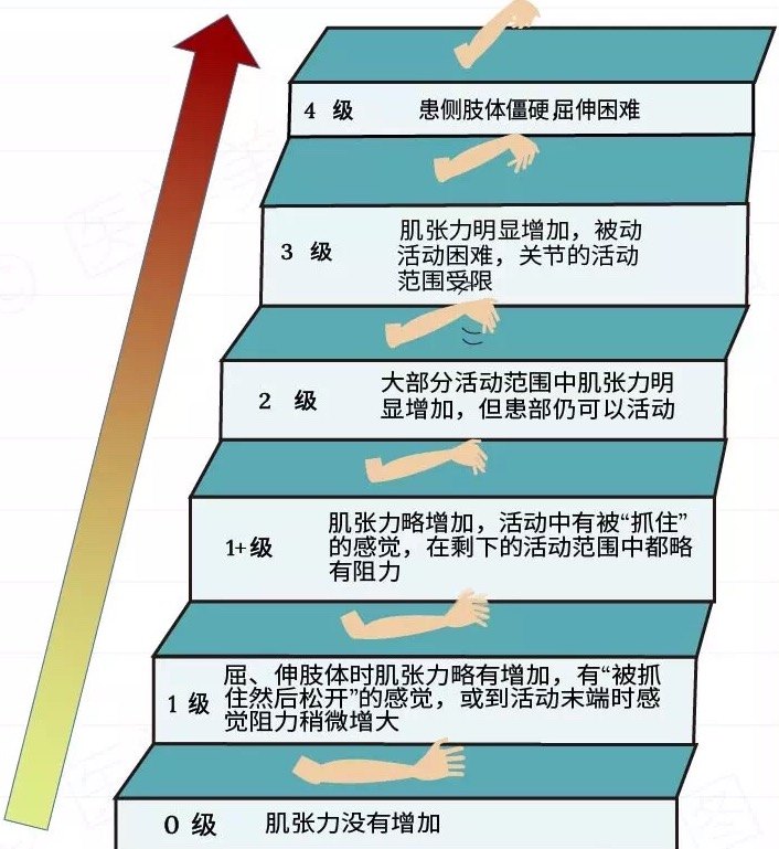 如何预防和治疗脑卒中患者的肢体痉挛