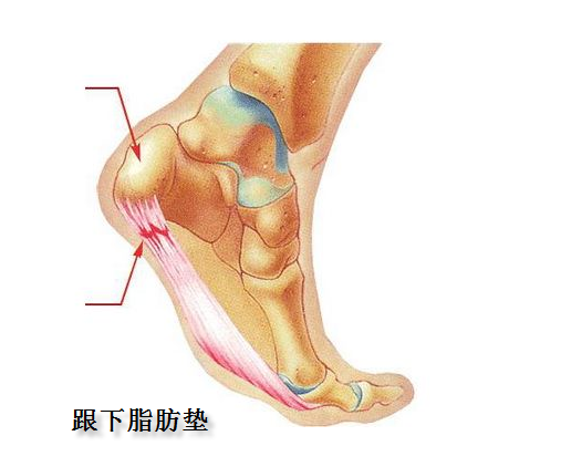 脂肪垫炎是老年人骨质疏松后,由于足底肌腱应力作用,继发骨质增生