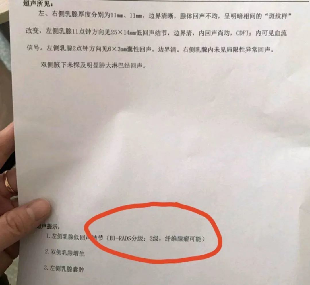 得了乳腺结节该怎么办?