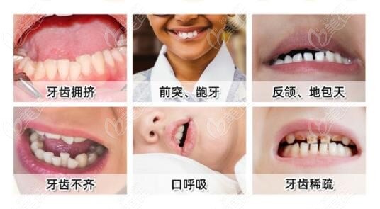 孩子牙齿排列不齐!不仅难看!还有这些危害!