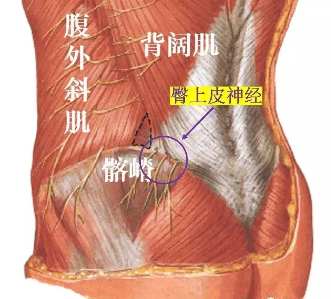 从筋膜的角度看腰痛 腰肌筋膜炎是个什么东西(附内热针治疗介绍)_筋膜