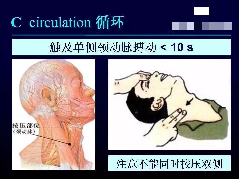 上帝之手—心肺复苏,你了解多少?