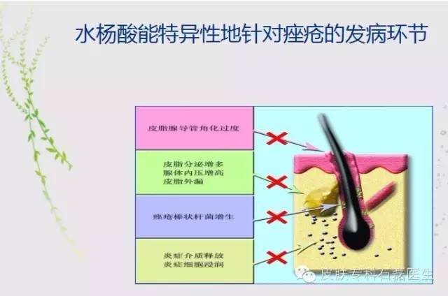 去痘又添新神器-水杨酸换肤 - 好大夫在线