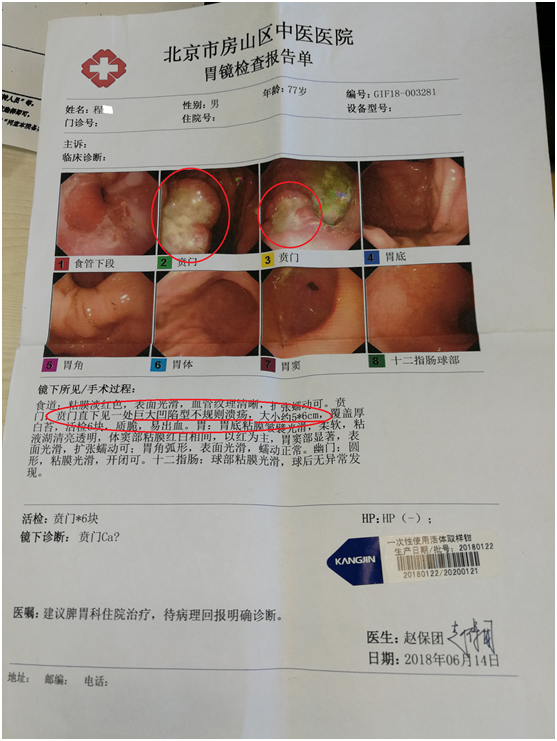 第2张图片是胃镜活检的病理报告.