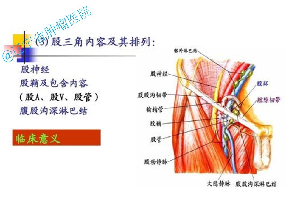 股三角区软组织肉瘤手术病例