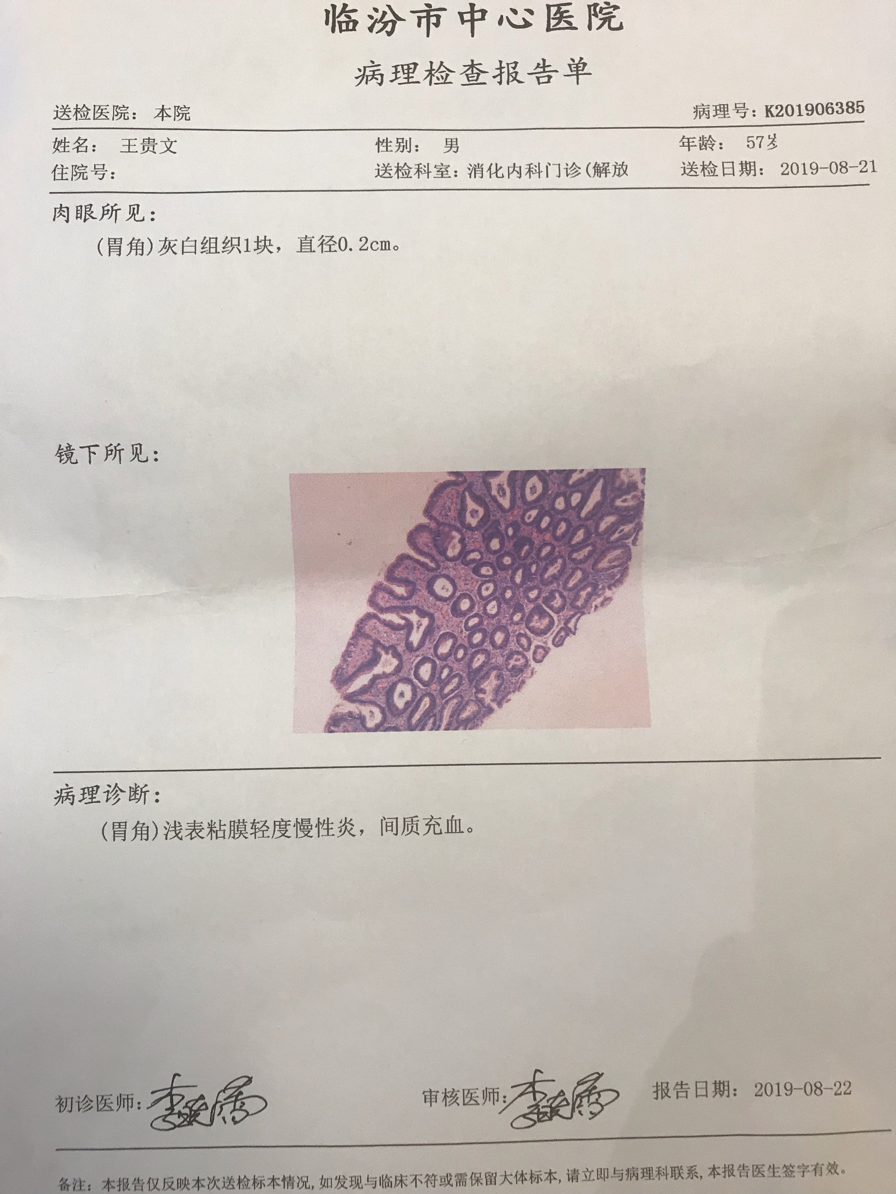 服用膏方治疗萎缩性胃炎伴肠化低级别内瘤变逆转报告