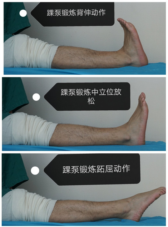 3 直抬腿     仰卧位垂腿