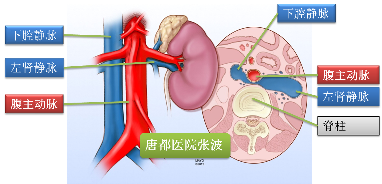 胡桃夹综合征10问