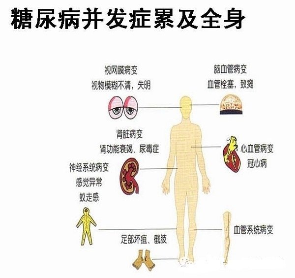 二三十岁患上了糖尿病,该怎么办?