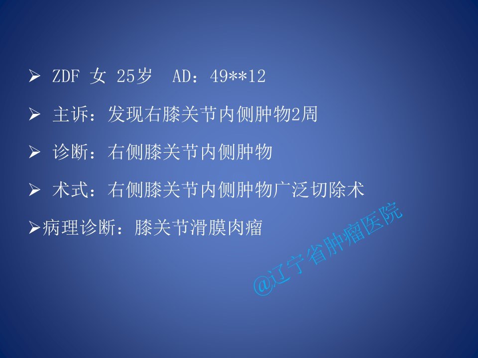 膝关节滑膜肉瘤切除术
