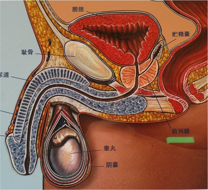 直肠前方前列腺位于膀胱出口,在肛门前方的会阴部深处(见下图,其形状