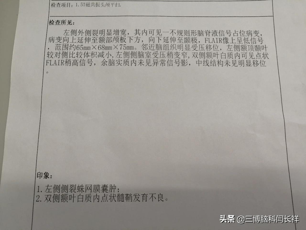 意外发现孩子的蛛网膜囊肿到底要不要治疗?_好大夫在线