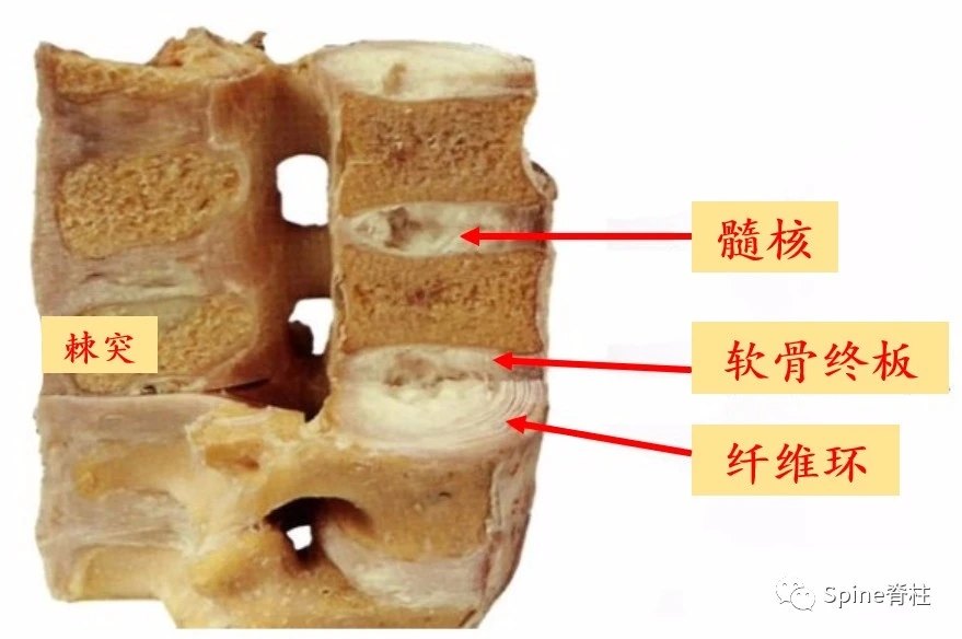 腰椎的基本结构单元:上下椎体 椎间盘 椎间盘由中间的髓核,周围的