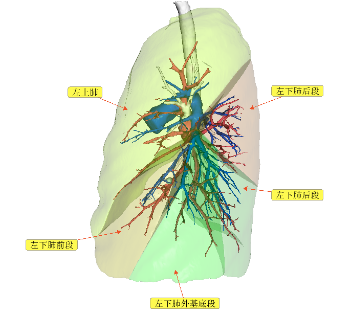 ct三维重建指导下的肺段切除术