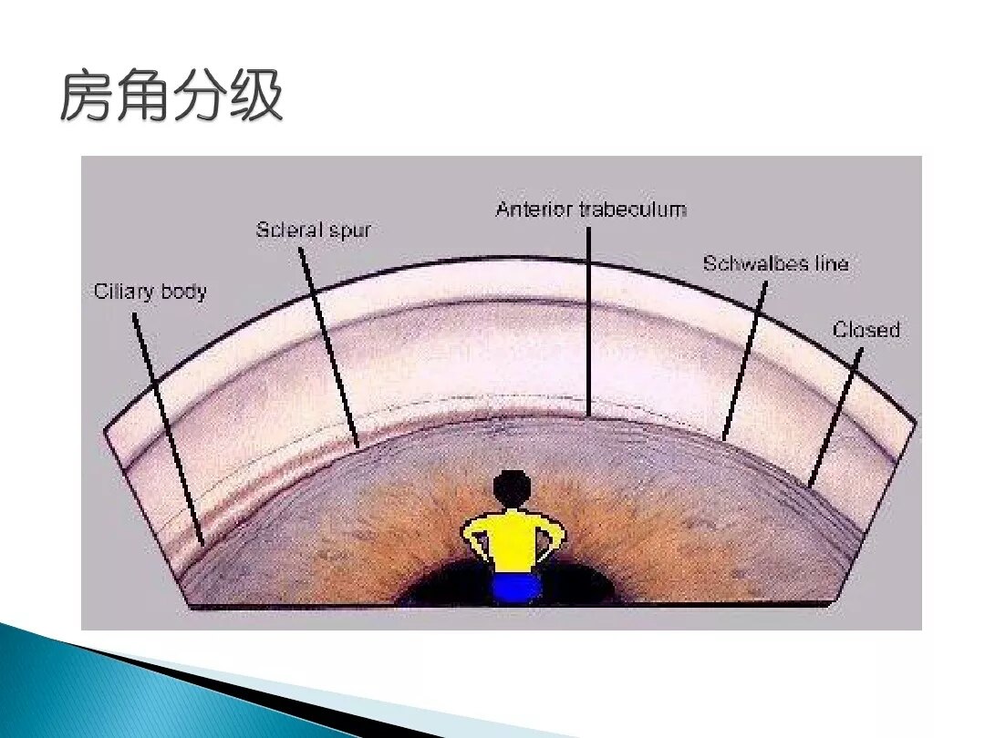 房角镜及三面镜检查