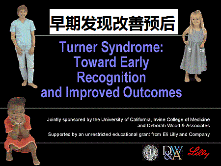 精神健康问题:患有turner综合征的女孩和妇女在社交场合中可能有困难