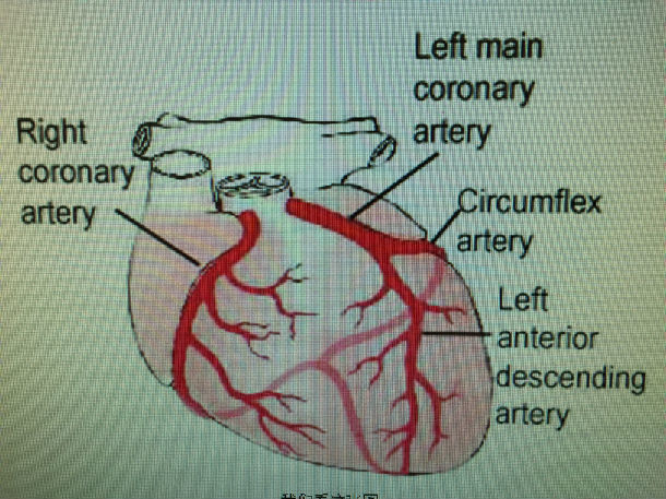 它主要包括左主干(left main coronary artery),左前降支(left