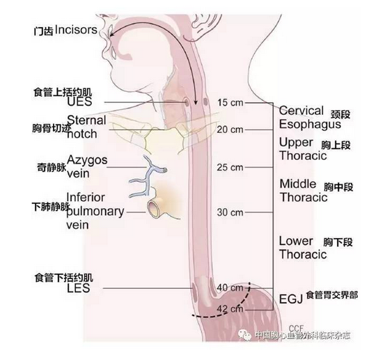 uiccajcc食管癌第八版分期