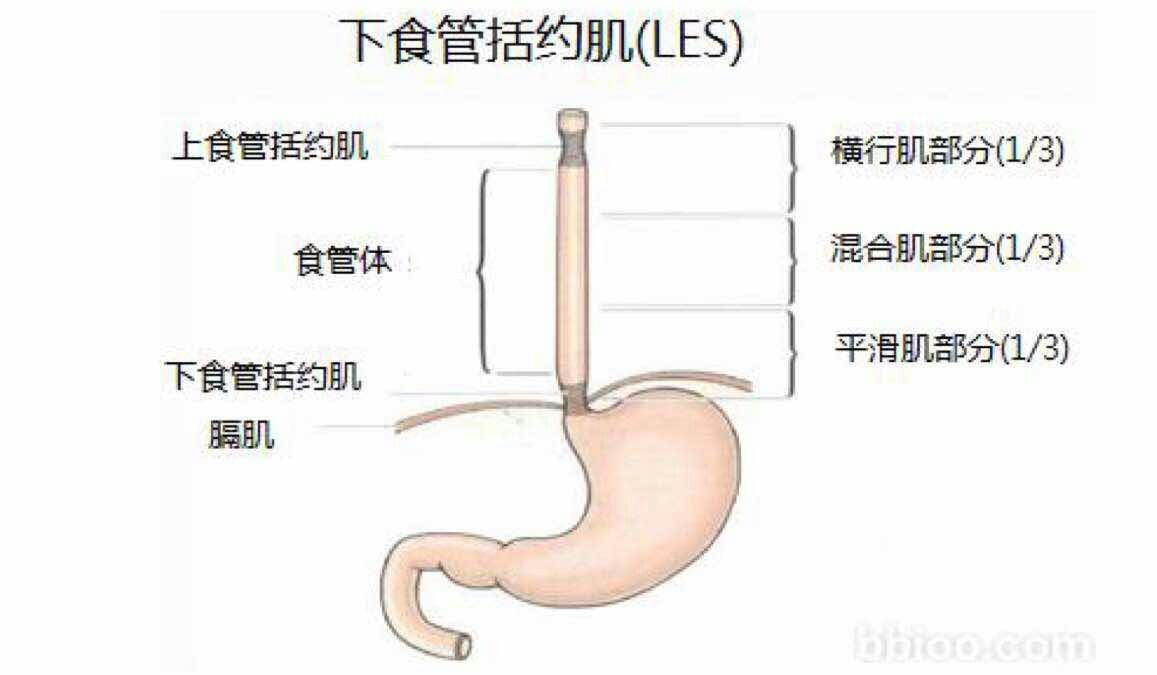 胃食管反流病是怎么回事