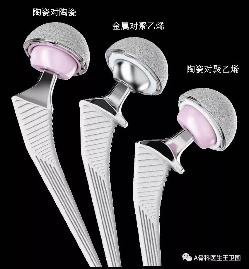 髋关节置换用陶瓷的还是塑料的