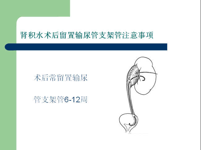 肾积水术后留置输尿管支架管注意事项